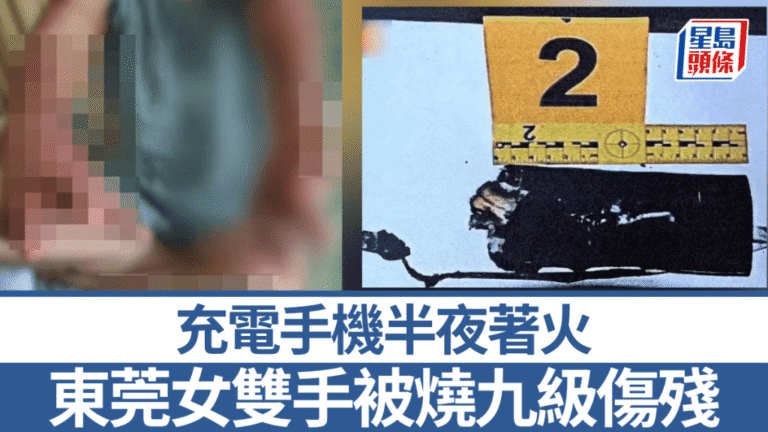 東莞女子邊充電邊用手機後入睡 手機起火致嚴重燒傷