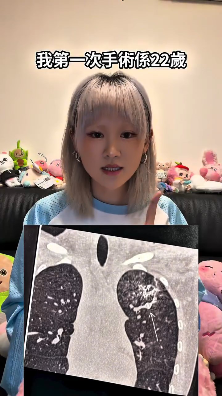 WinWin第一次進行手術時只有22歲。