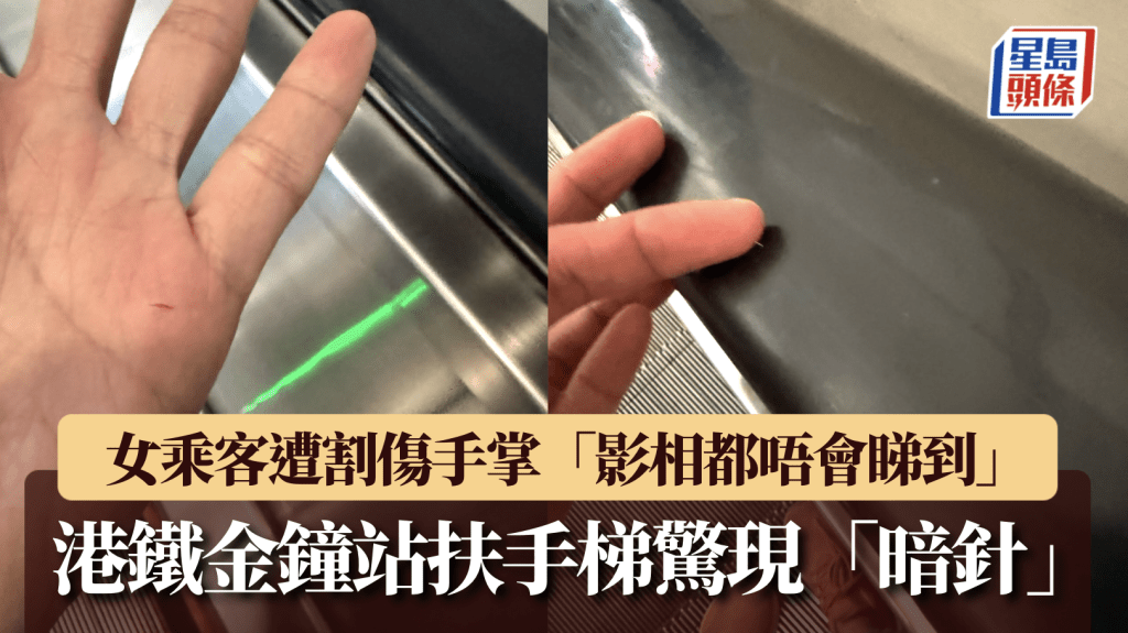 金鐘站扶手電梯扶手帶藏針 女乘客手部遭刺傷送院