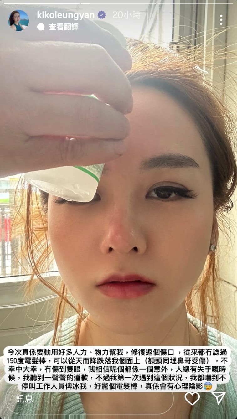梁茵受傷後,獲得不少朋友和網民的關心。