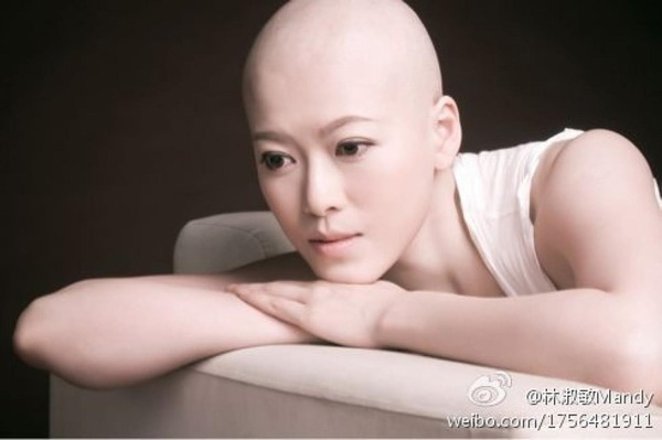 林淑敏早年透露於2010年患上第二期乳癌，現已康復。