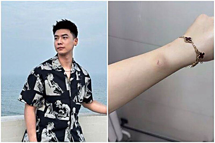 齊昕苒指控交往期間遭王塏智多次家暴。網上圖片