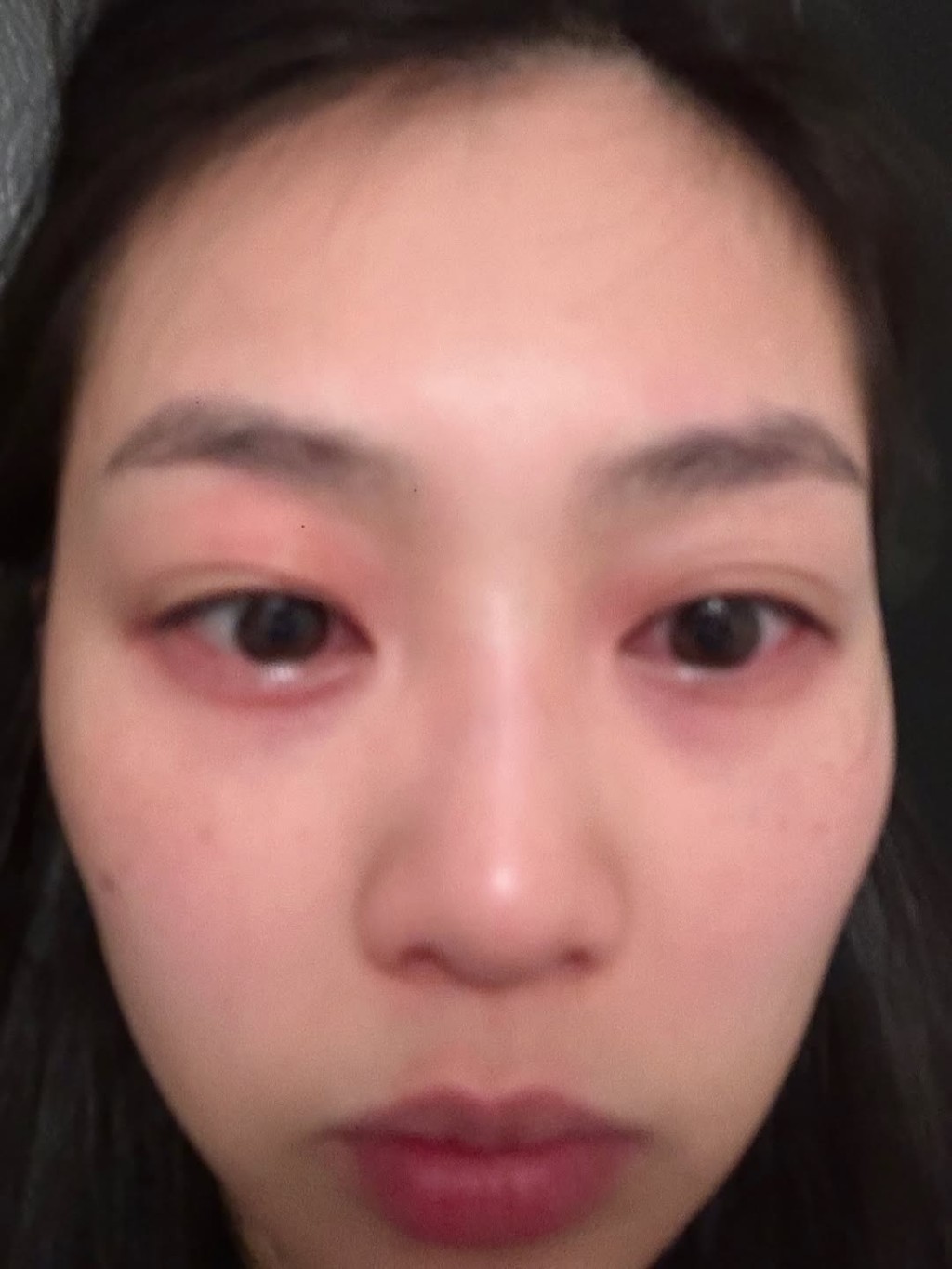 郭柏妍當時雙眼極為紅腫。
