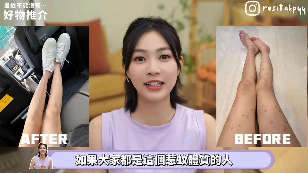 塗抹藥膏約一星期後,她腿上的紅腫情況已有改善。