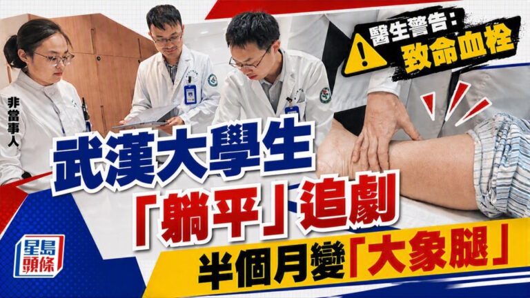 武漢大學生久臥追劇致腿部血栓 醫生提醒深層靜脈栓塞風險