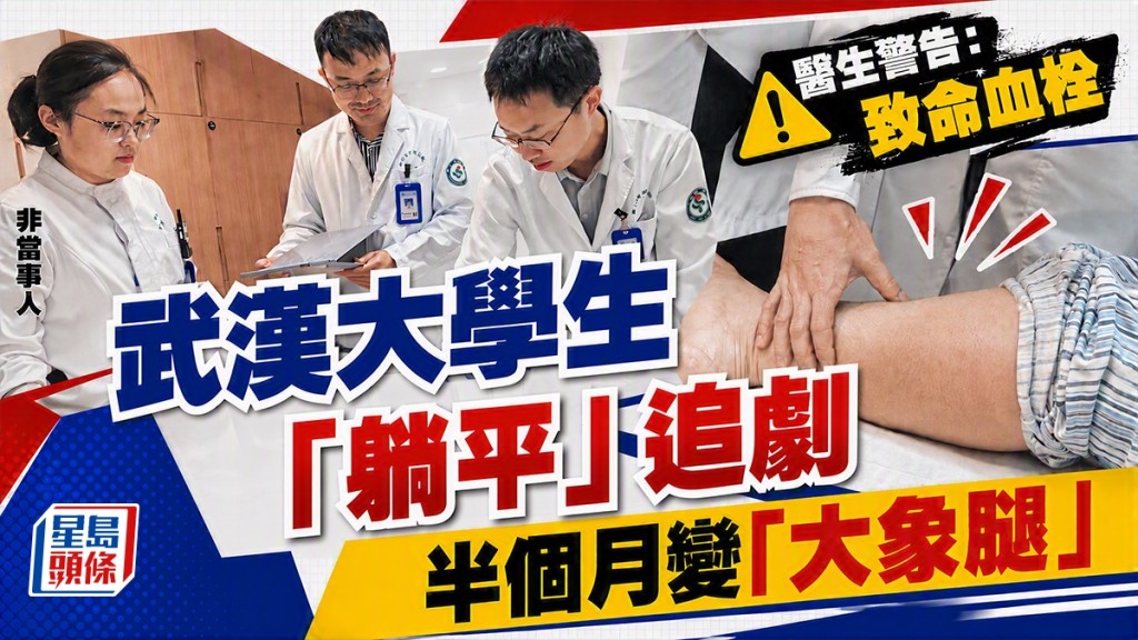 武漢大學生久臥追劇致腿部血栓 醫生提醒深層靜脈栓塞風險