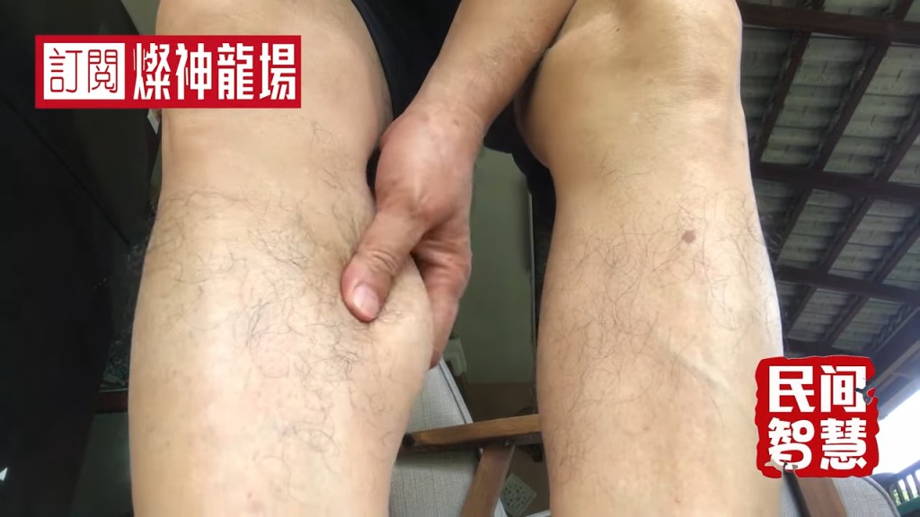 廖偉雄發現左腳肌肉有明顯「縮水」跡象。