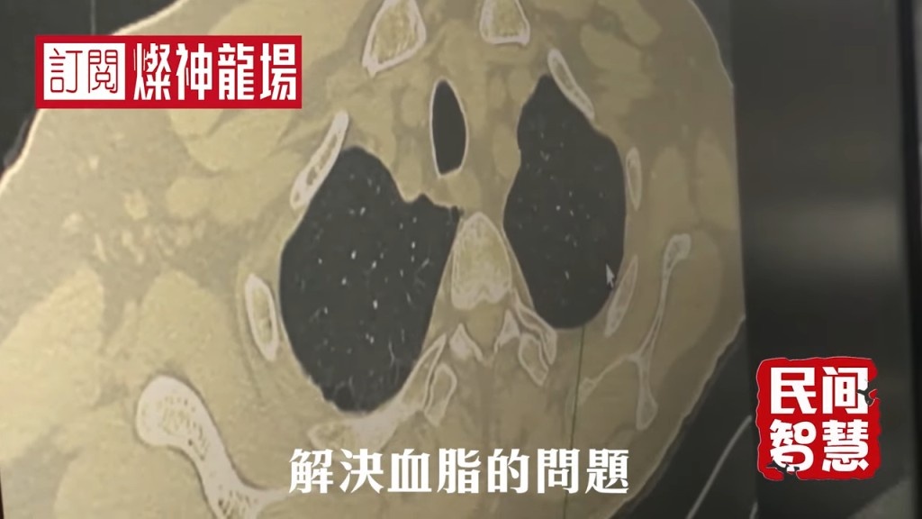 廖偉雄曾進行身體檢查。