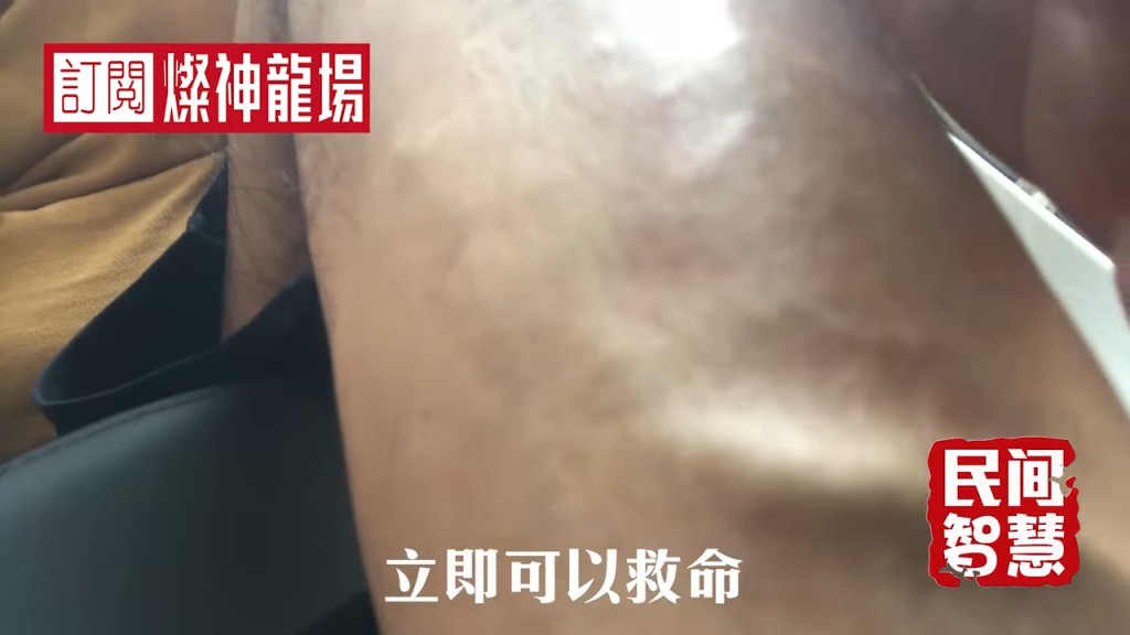 廖偉雄認為有時一粒藥能保住性命。