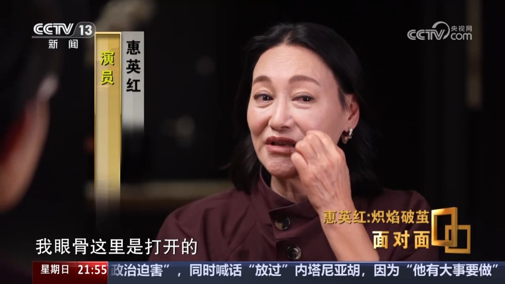 惠英紅回憶當時受傷的具體情況。