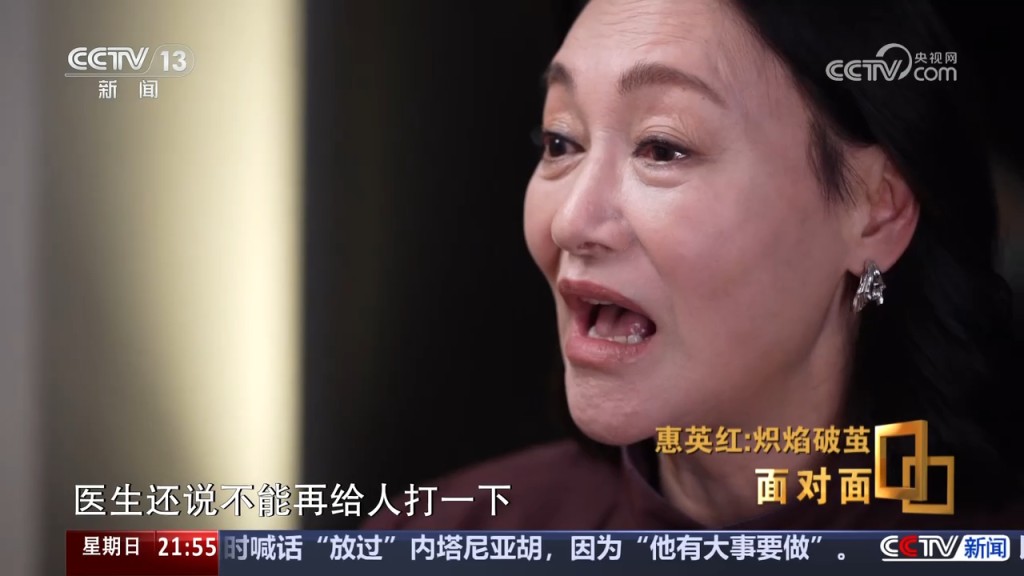 惠英紅憶述醫生當時警告,若臉部再受一擊,眼珠都可能掉出來。