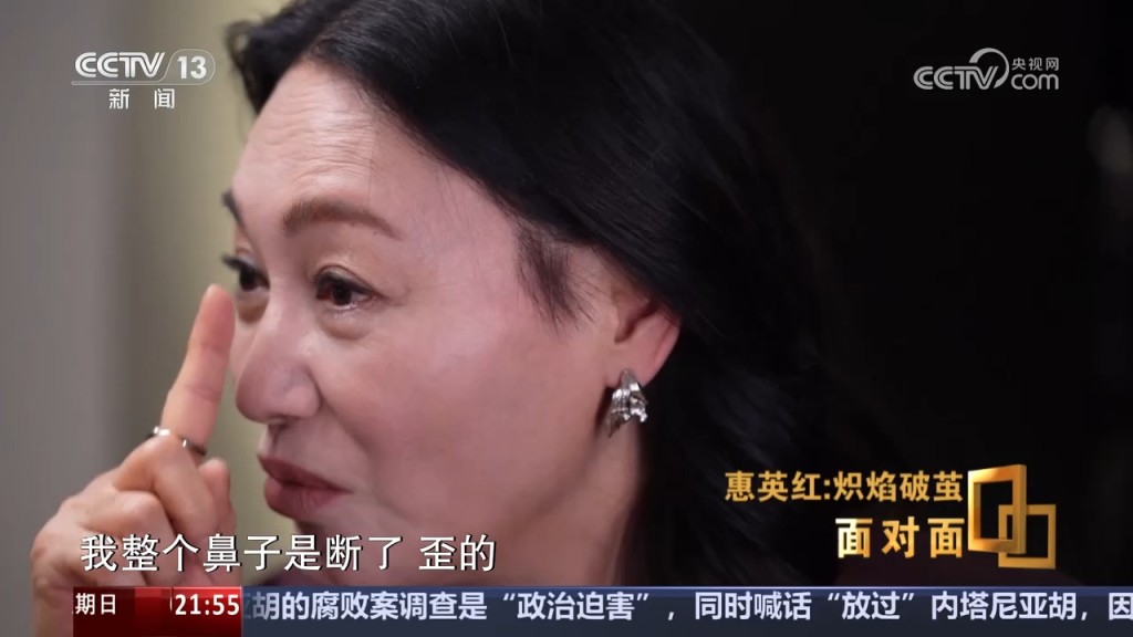 惠英紅描述當時鼻樑斷裂,導致呼吸困難。