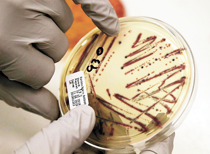 微生物學家分離出大腸桿菌菌落。美聯社資料照片