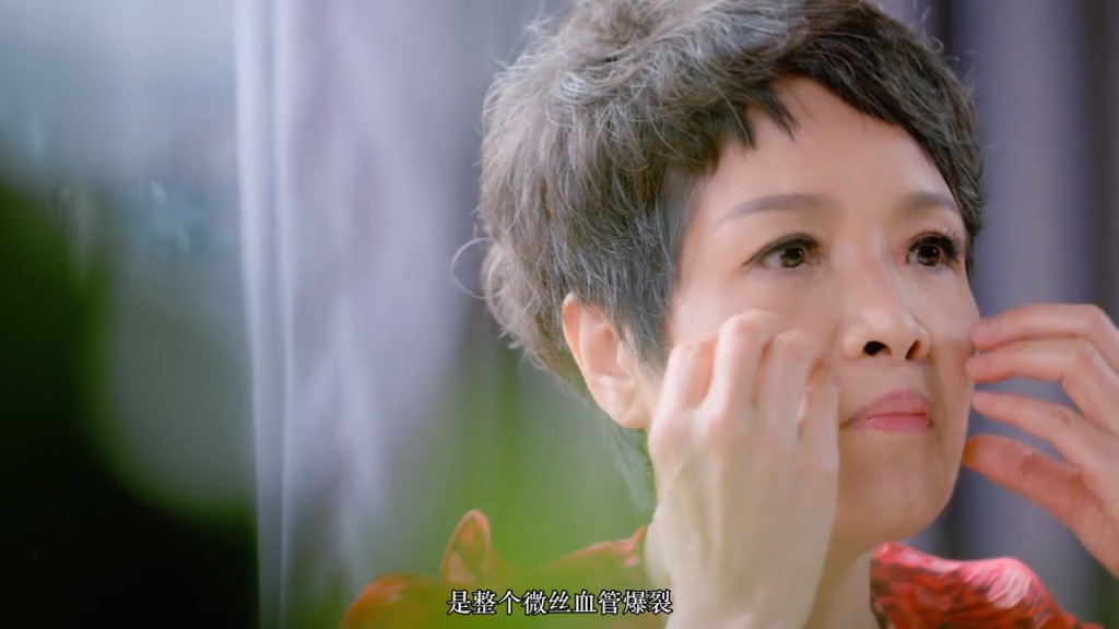 寶珮如當年原來被打至微絲血管爆裂。
