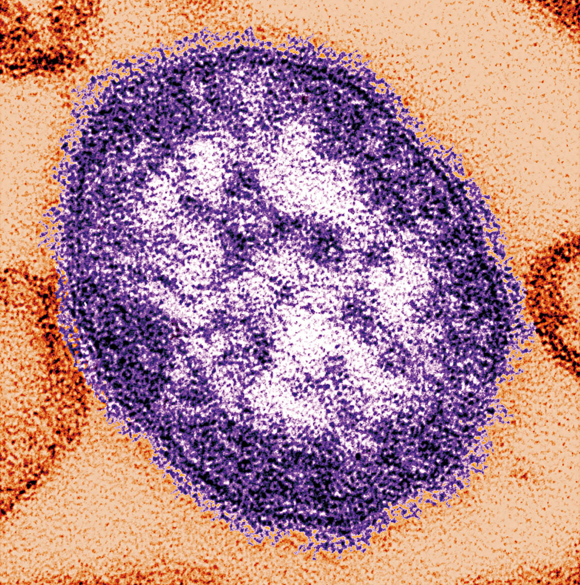 CDC提供電子顯微鏡影像下的麻疹病毒顆粒。美聯社