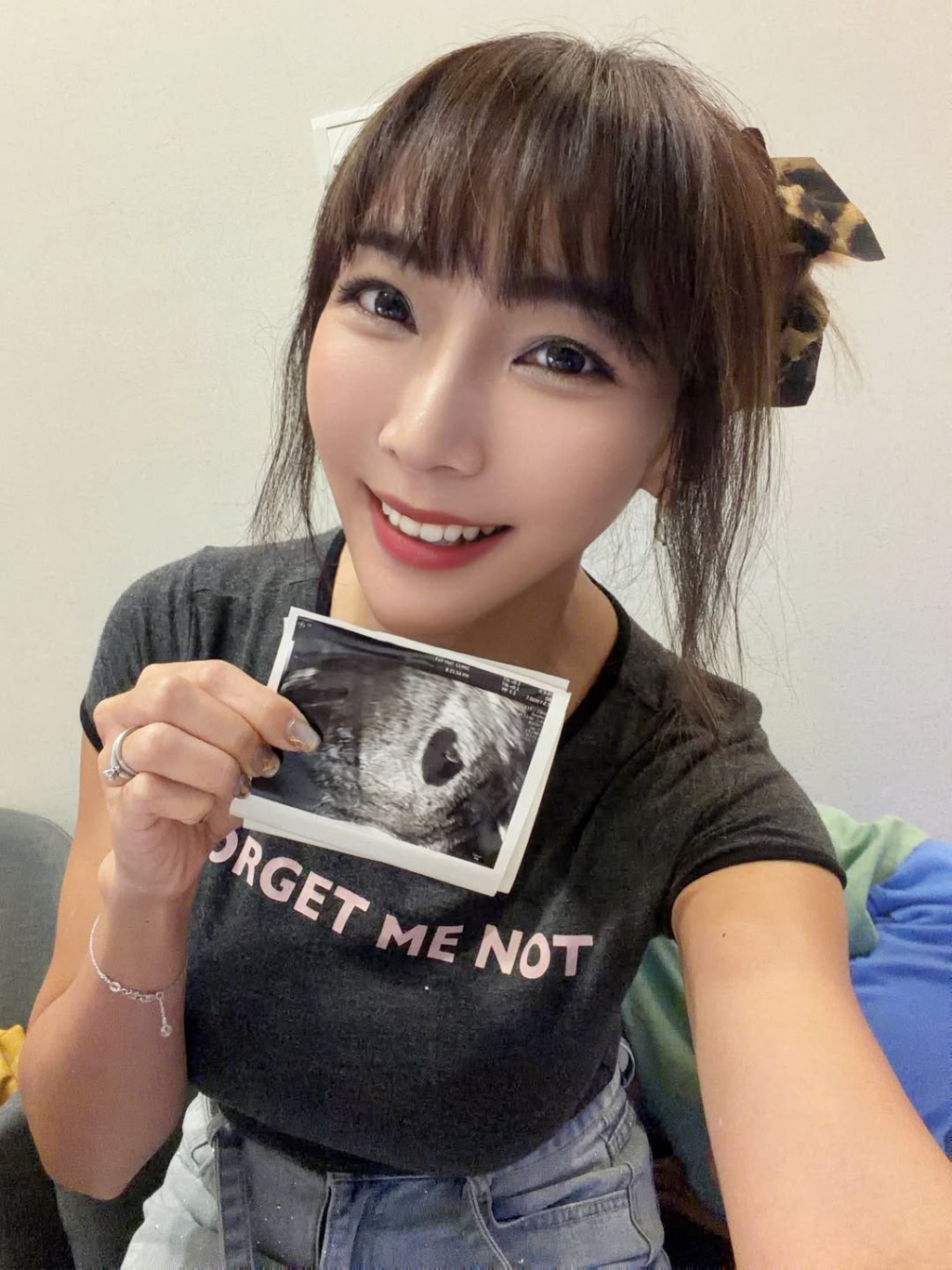 李宓過去一直依靠試管嬰兒療程受孕，沒想到這次出現驚喜。