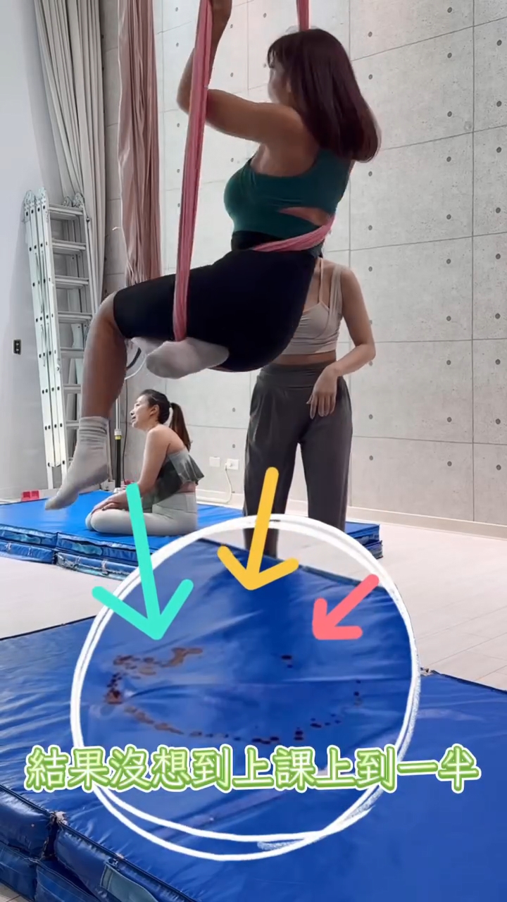 李宓在接受腹部拉皮手術後去做運動，期間傷口突然爆裂。