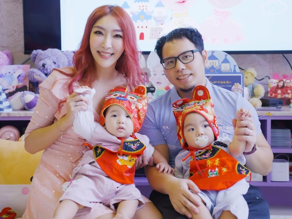 李宓曾公開承認進行過整容手術。