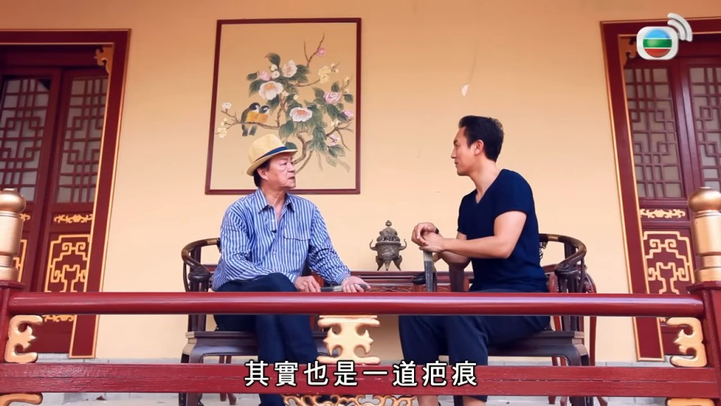 對於當年嚴苛做法,狄龍坦言此事在他心中「其實也是一道疤痕」。