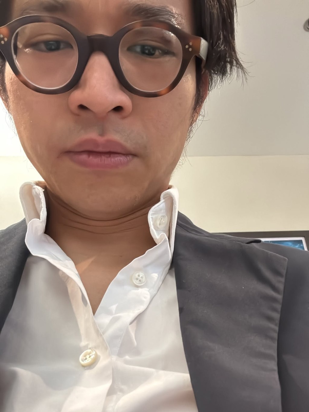 林作戴上厚框眼鏡，試圖遮掩眼部傷勢。