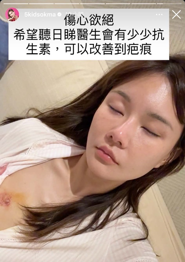 五索胸部傷口曝光,闊度約兩吋。
