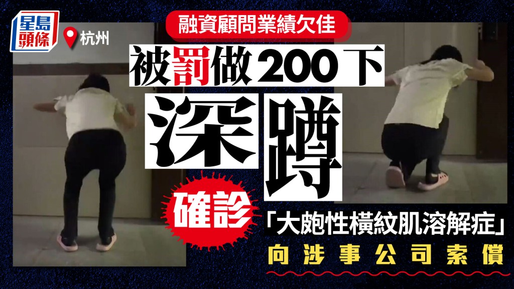 杭州女職員因業績不達標被罰深蹲 引發橫紋肌溶解症