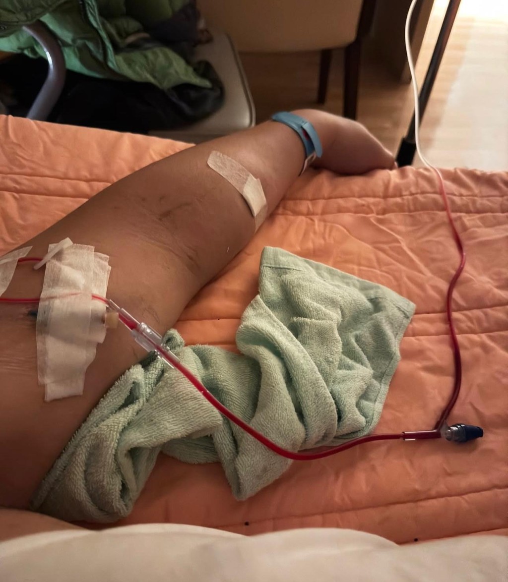 王喜透露自己患上急性腎衰竭。