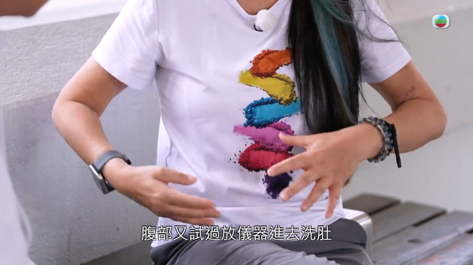 陳存正透露曾需要在腹部置入儀器進行洗肚。