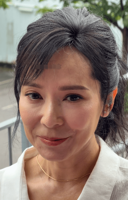 郭羨妮被指上唇極薄,樣子與以往有異。