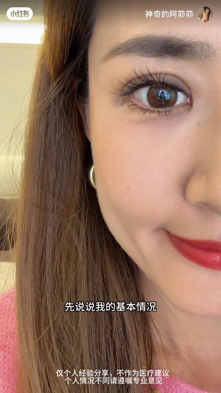 張茆表示，上眼皮下垂讓她失去了昔日的神采。
