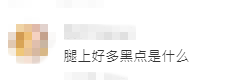 何超蓮腿上的黑點引起網民好奇。