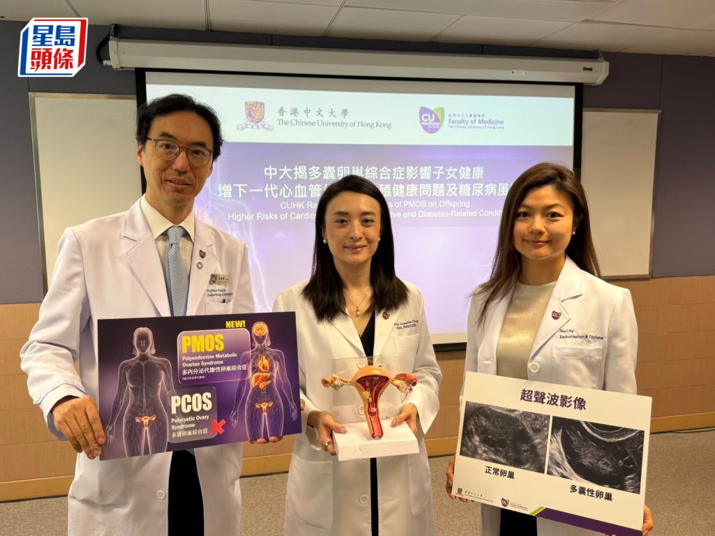 中大研究：多內分泌代謝性卵巢綜合症影響可傳至下一代