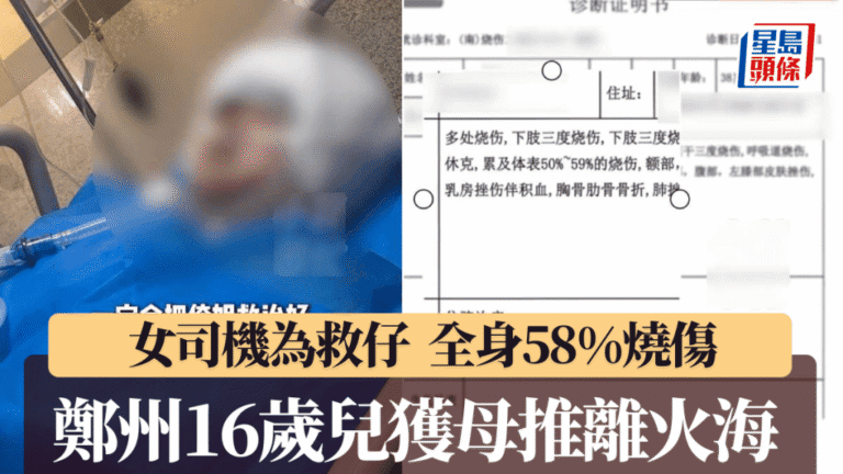 河南車禍母親奮力推子逃生 全身近六成燒傷未脫險