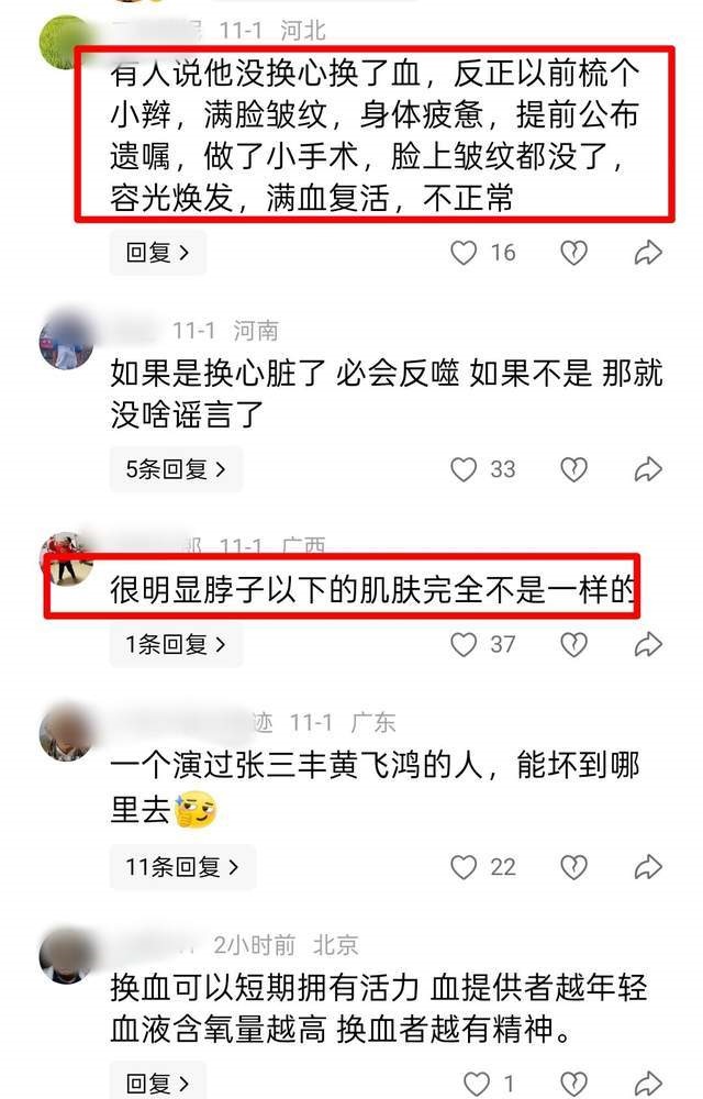 曾有網民猜測李連杰並非換心,而是換血。