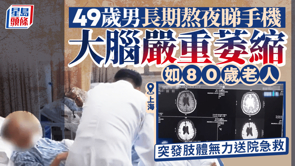 上海中年男子長期熬夜使用手機 腦部萎縮程度相當於80歲