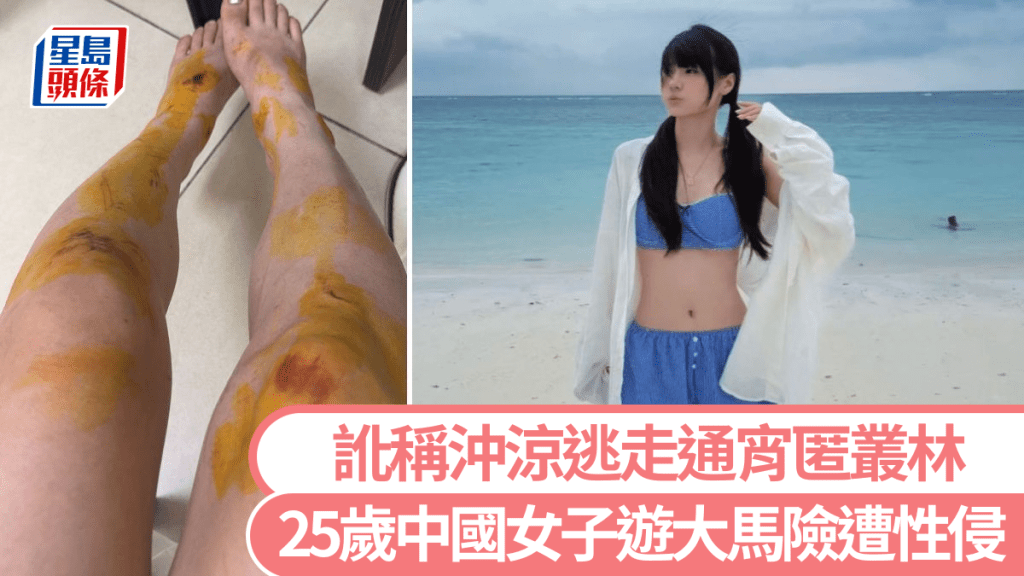 中國女遊客馬來西亞酒店遇襲 機智脫險後報警