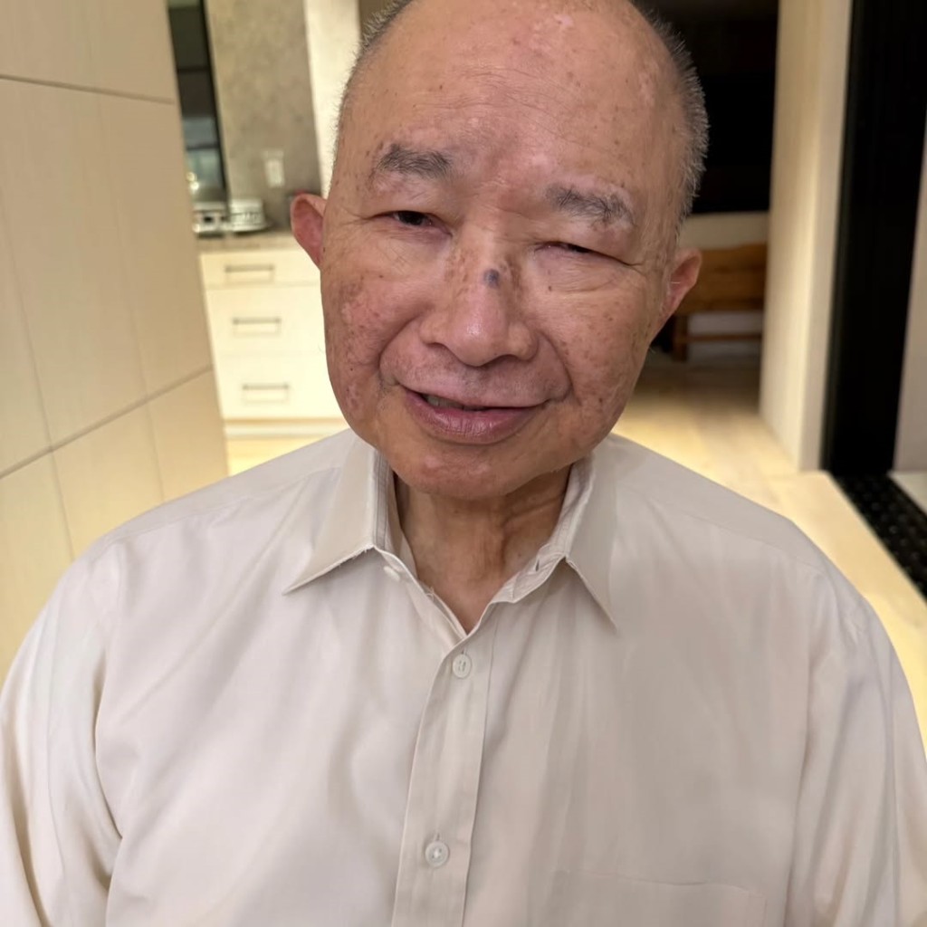 吳宇森的左眼似乎有無法完全睜開的情況。