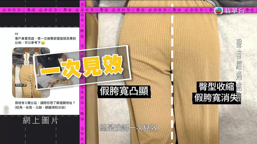 涉事店舖使用「一次見效、假胯寬消失」等字眼招徠顧客。