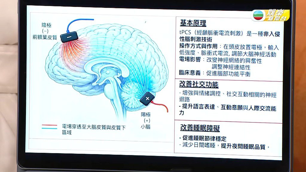節目組以螢幕圖解，向張致恒展示其兒子現正接受的「經顱磁脈衝刺激治療」運作原理。（影片截圖：《流行都市》）