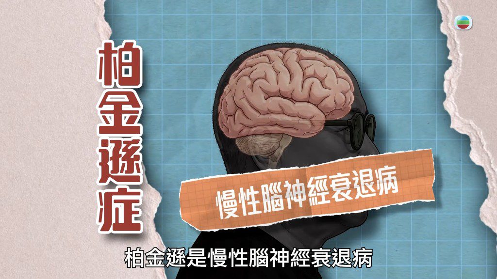 檢查後,嚴秉泉醫生才知道那是早期柏金遜症的症狀。
