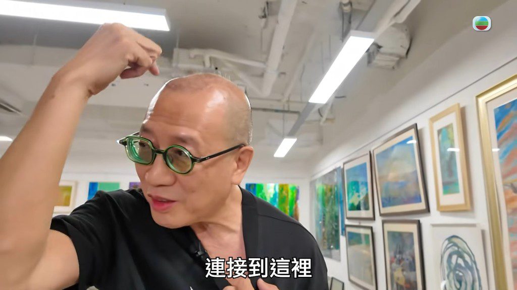 他繼續說明:「然後去到這裡(頭頂),分開兩條,左右腦都有起搏器。」