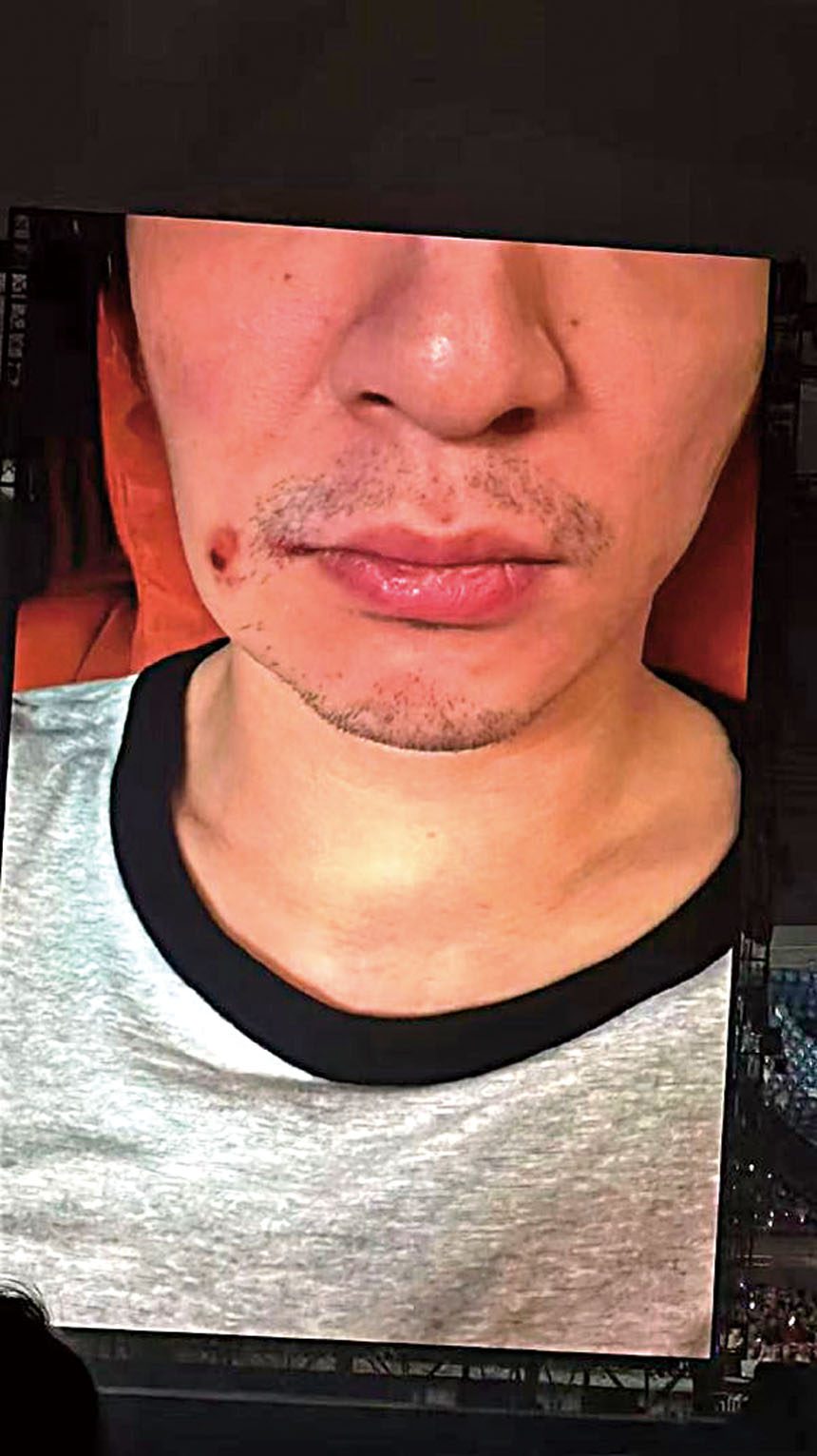 薛之謙將素顏腫臉畫面投放在演唱會大屏。網上圖片