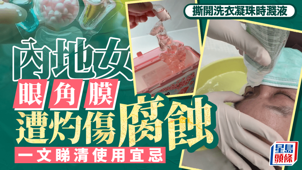 洗衣凝珠使用不當可致眼角膜灼傷 專家詳解安全使用要點
