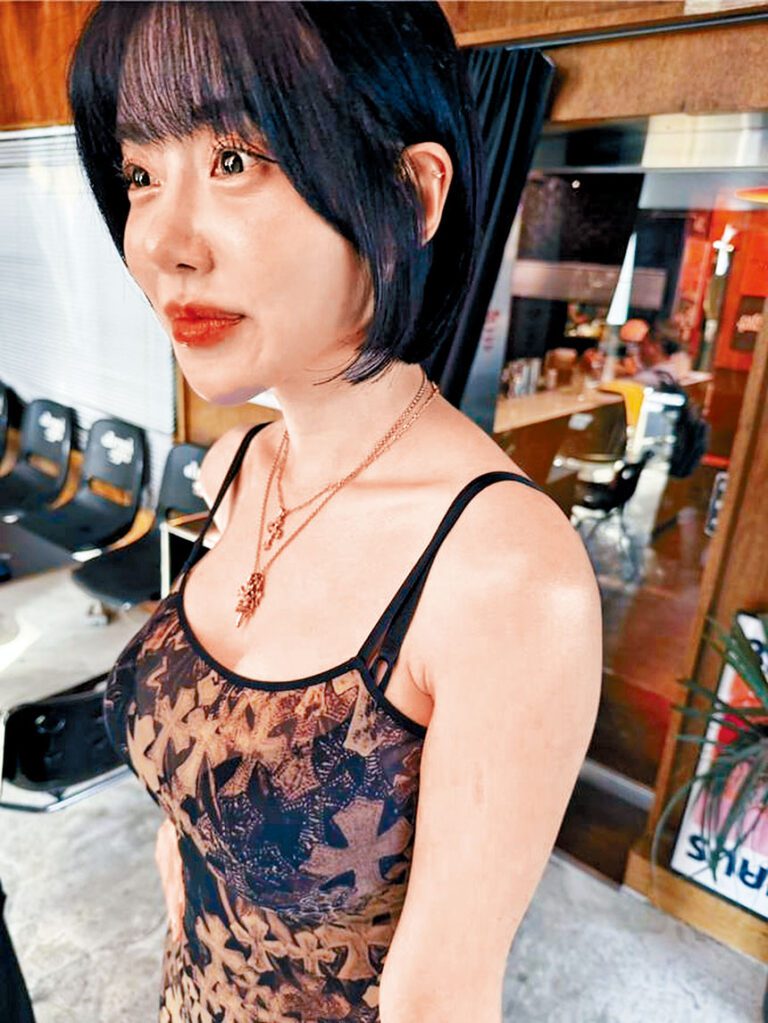 ■DJ SODA初戀遇著酗酒家暴Rapper，曾被對方爆樽襲擊，左手手臂至今仍見5厘米長傷痕。中時新聞網