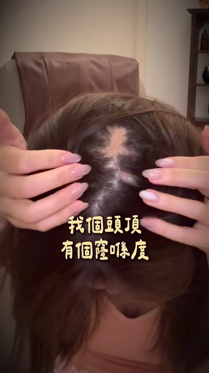 五索有「鬼剃頭」問題,頭頂明顯出現禿髮位置。