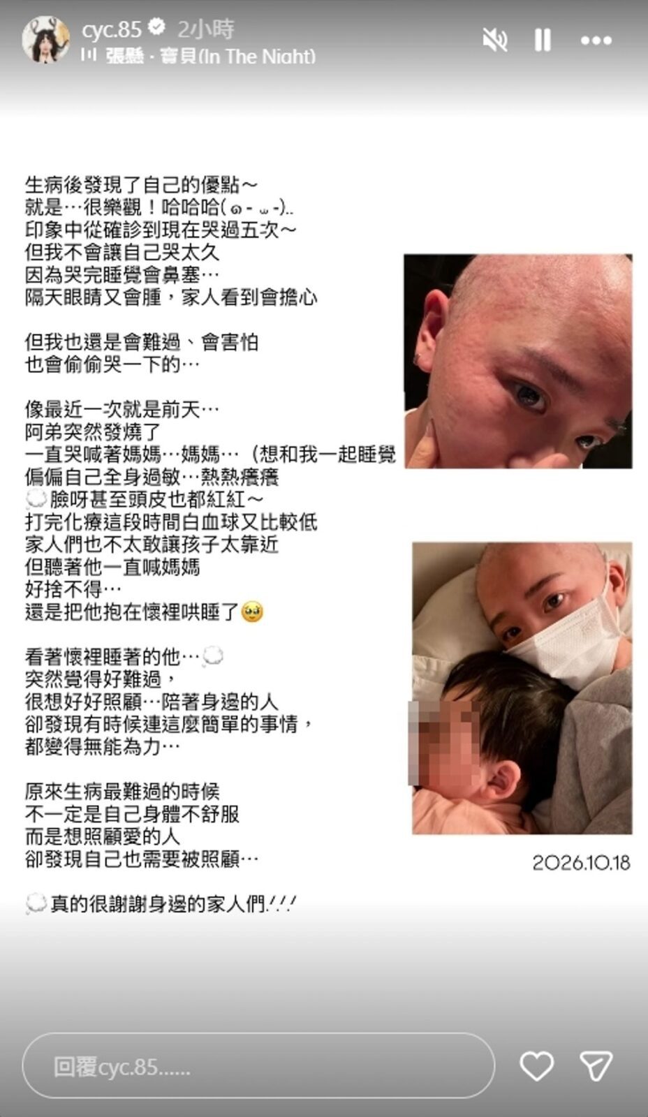 陳語謙在IG限時動態分享,化療後出現副作用,引致全身嚴重過敏。