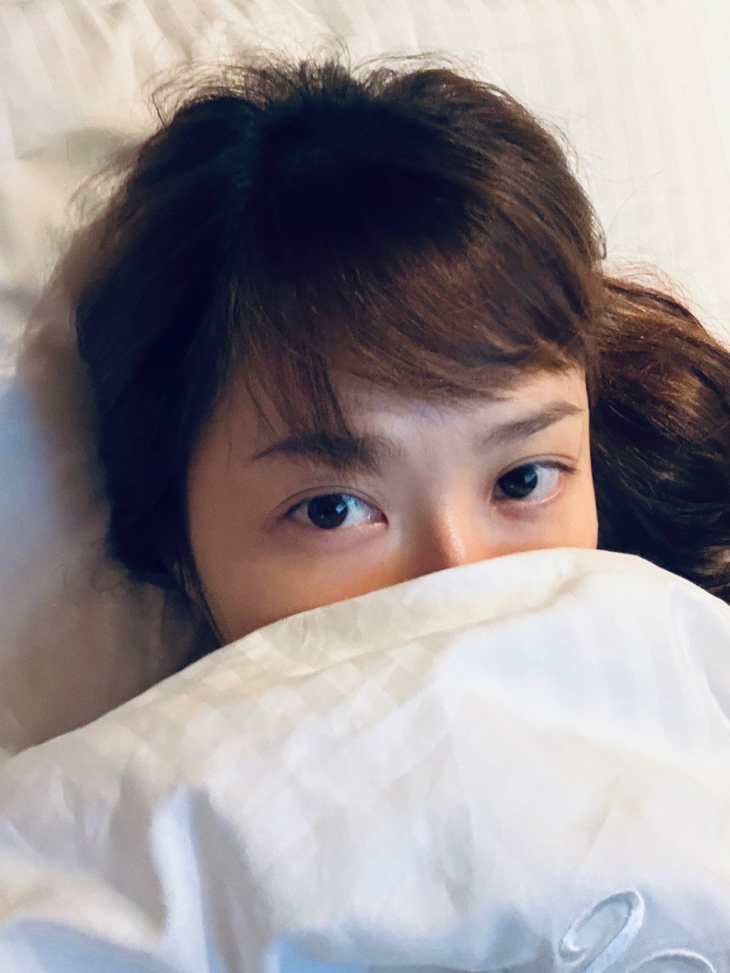 她昨日(24日)公開了手術後的病容。