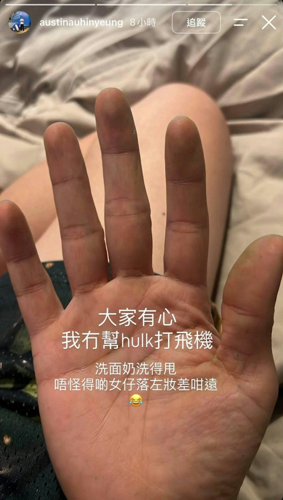 區顯揚發文求助如何清洗手上的綠色顏料。